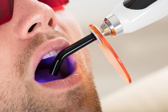 Teške bolesti koje izazivaju kvarni zubi